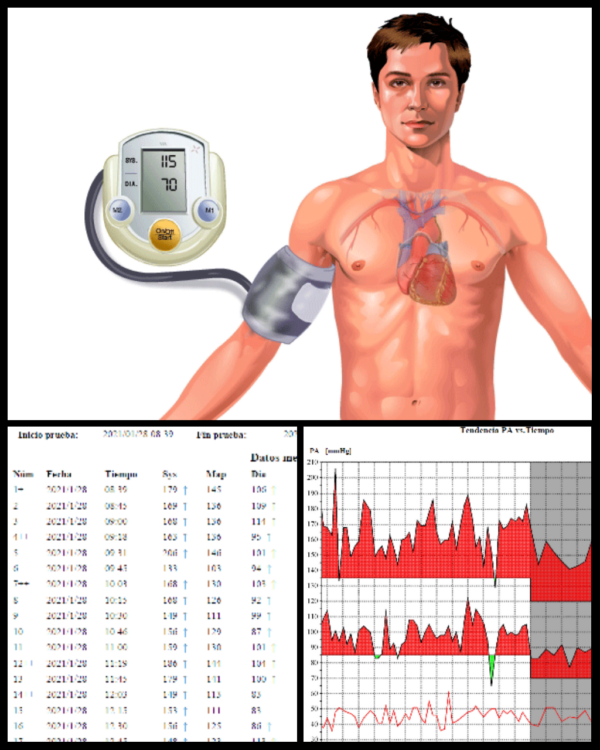 Examen de monitoreo automático de presión arterial