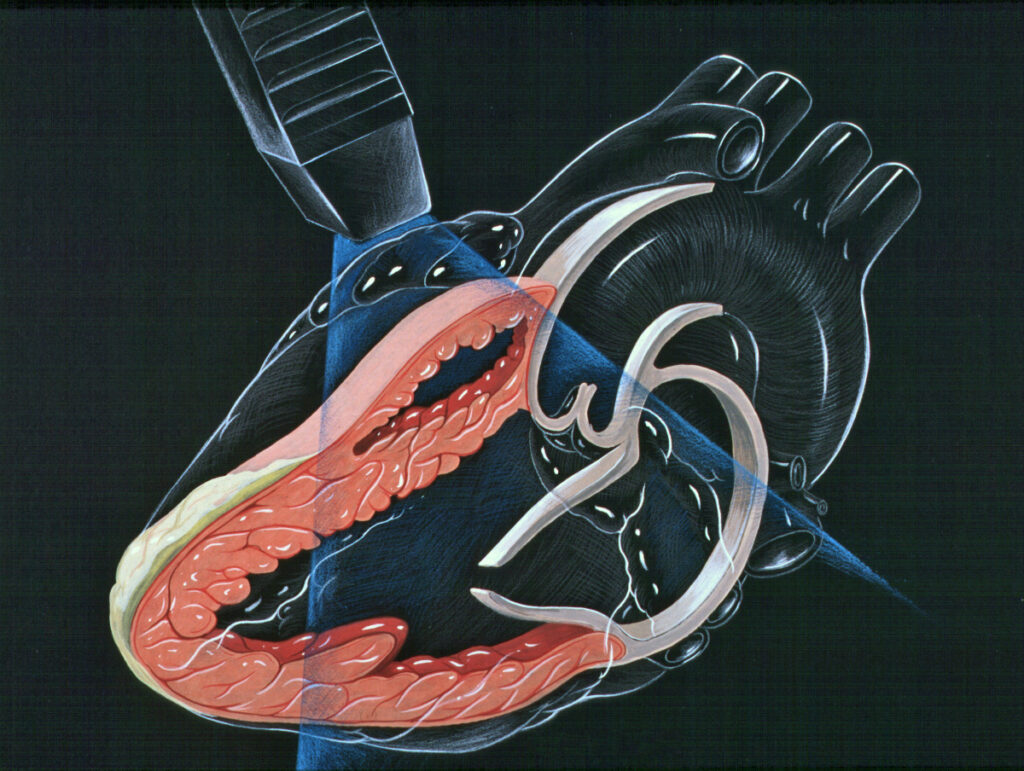 ecocardiograma transtoracico