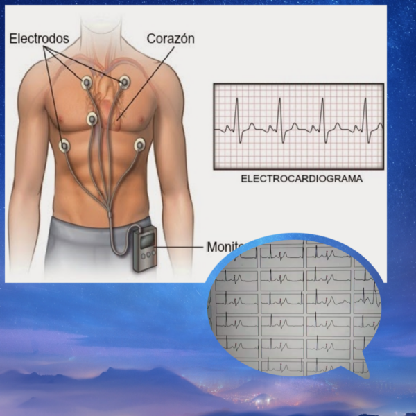 holter ritmo 24 horas